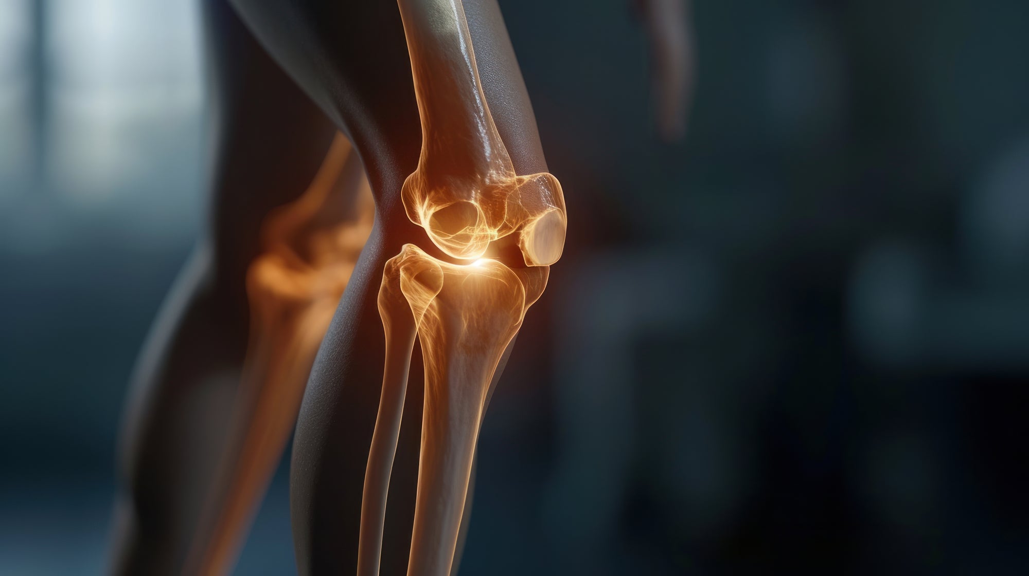 Mobility Restoration