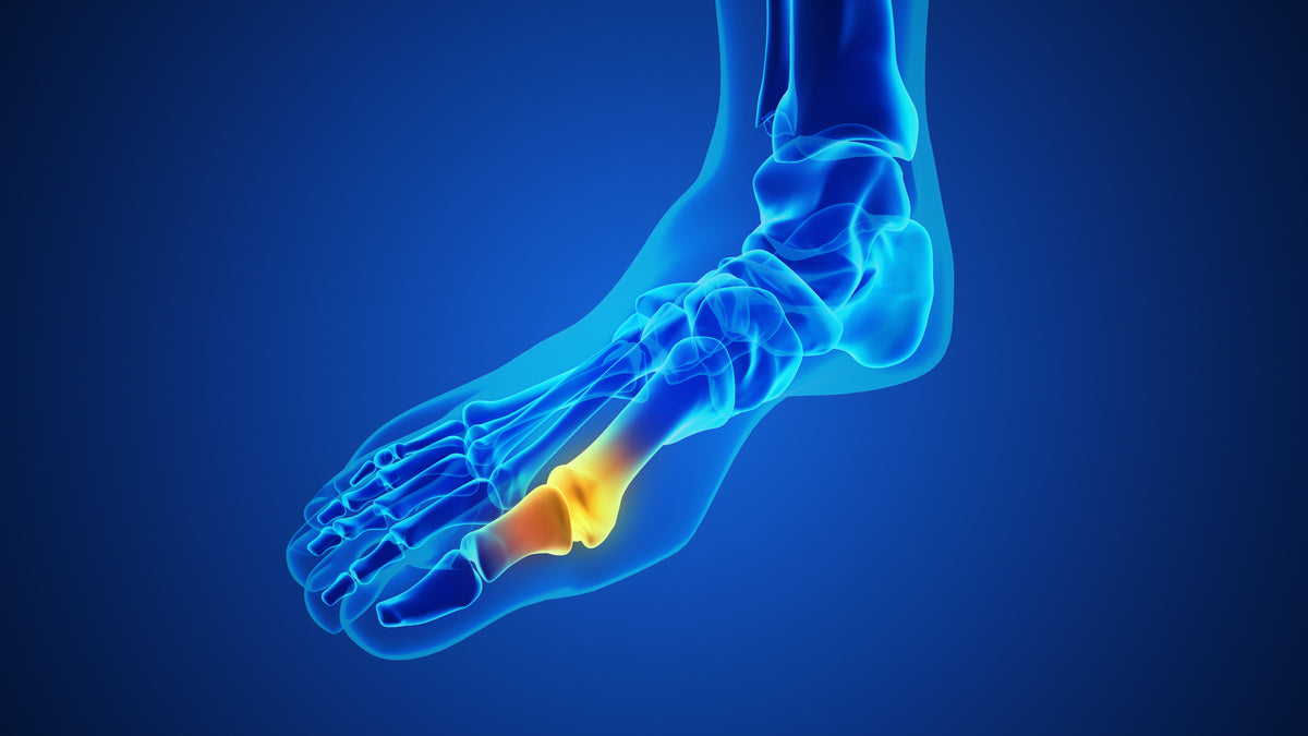 Joint Comfort & Uric Acid Balance