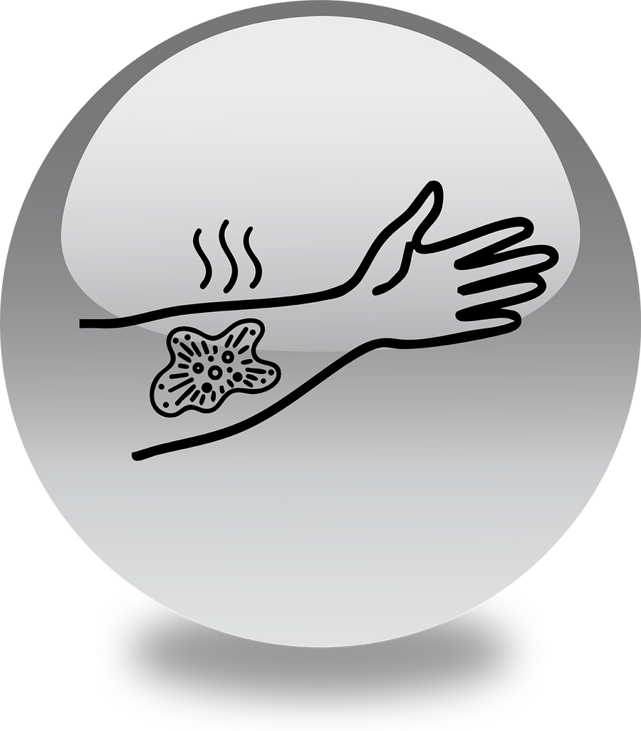 Symptom illustration