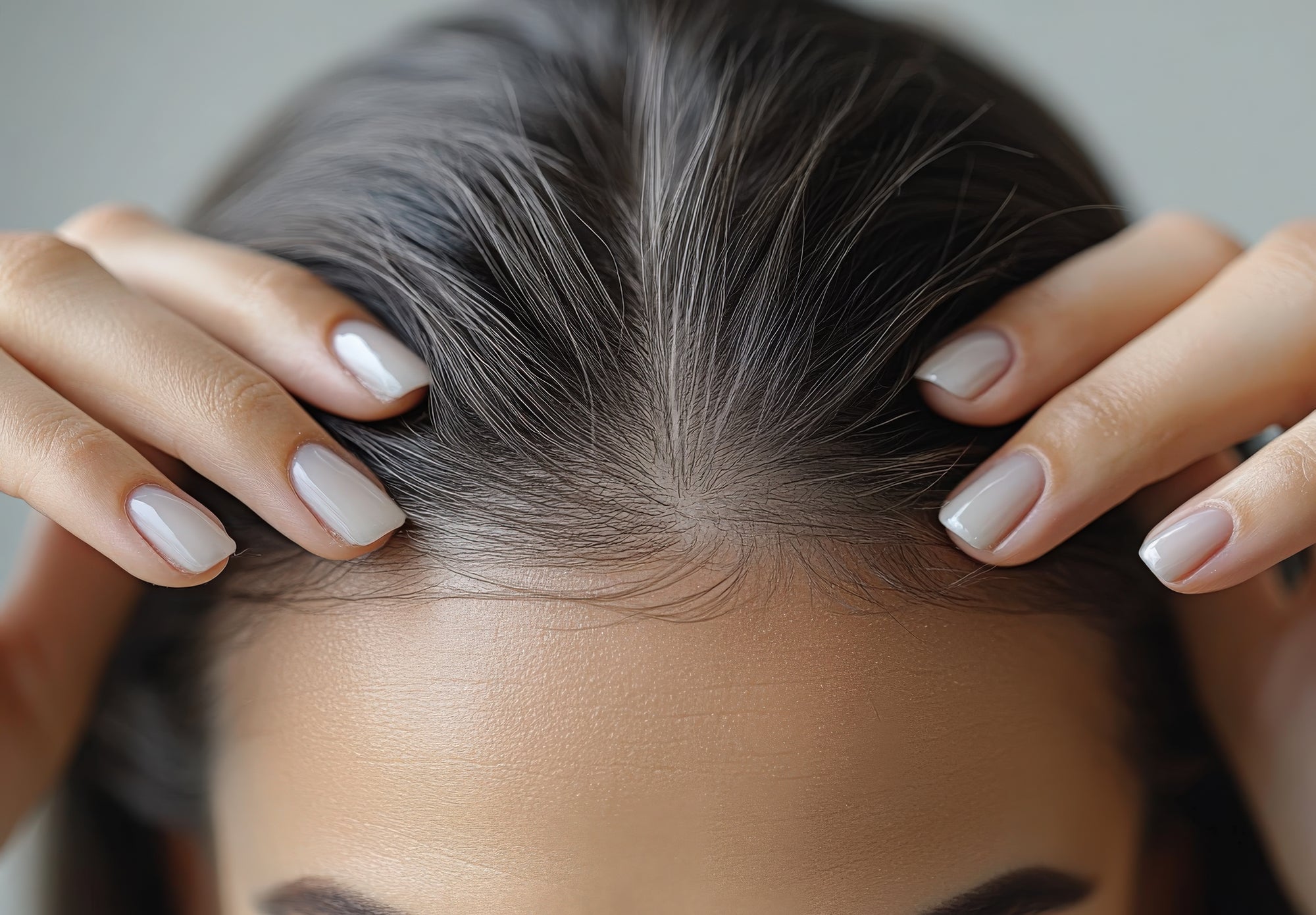 Scalp