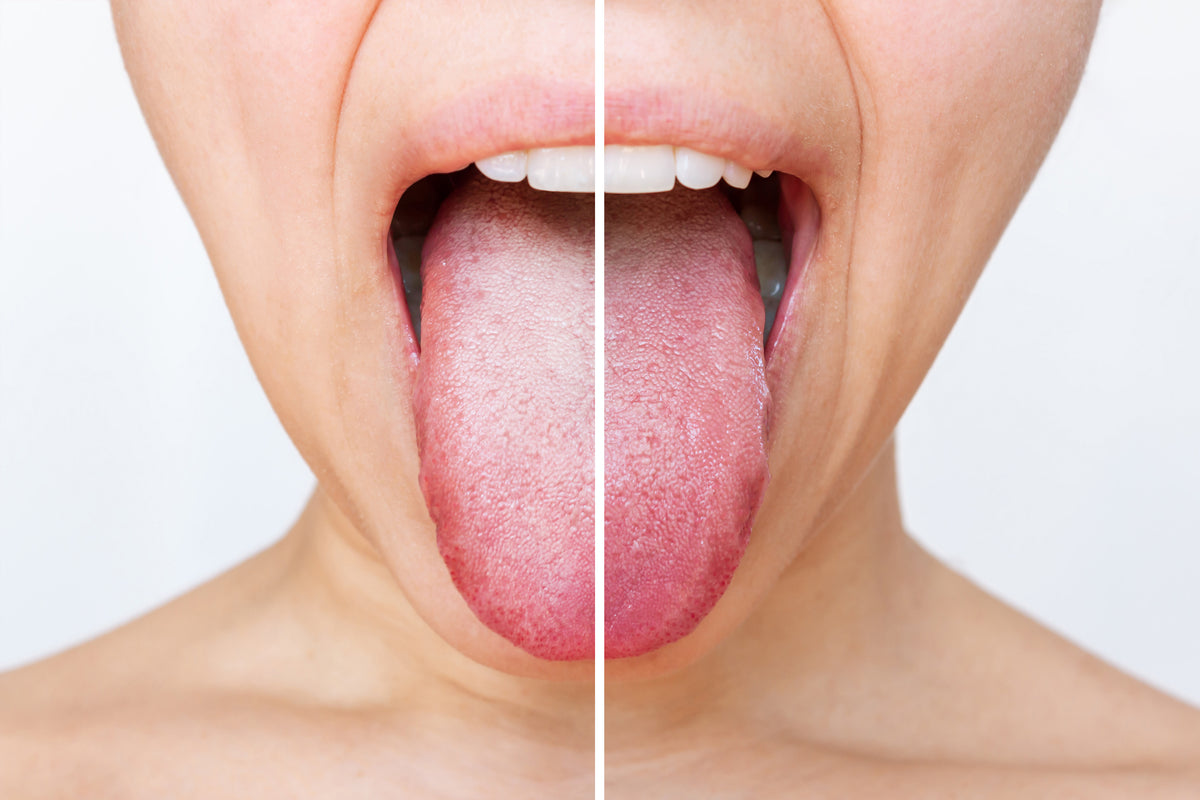 Tongue Scraping